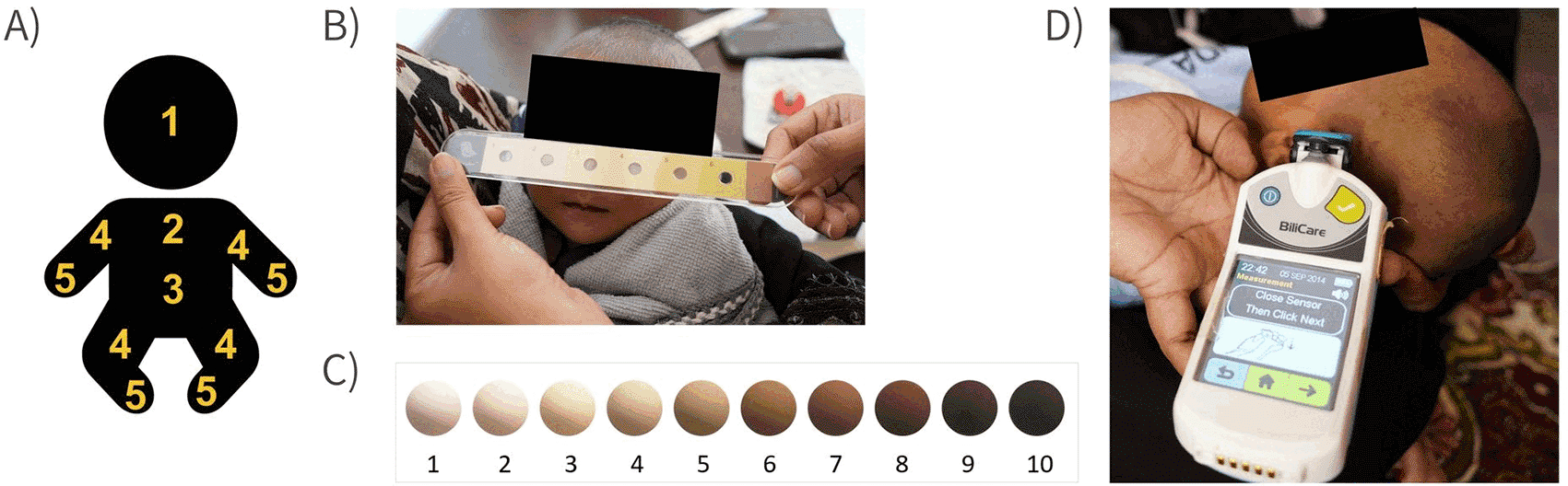 Bili Ruler Protocol for the Multi-Country Evaluation of... | VeriXiv